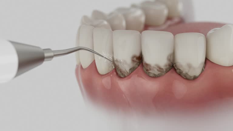 Reliable Emergency Dentist contractor in Lowell, MA by Smile Center Dentistry